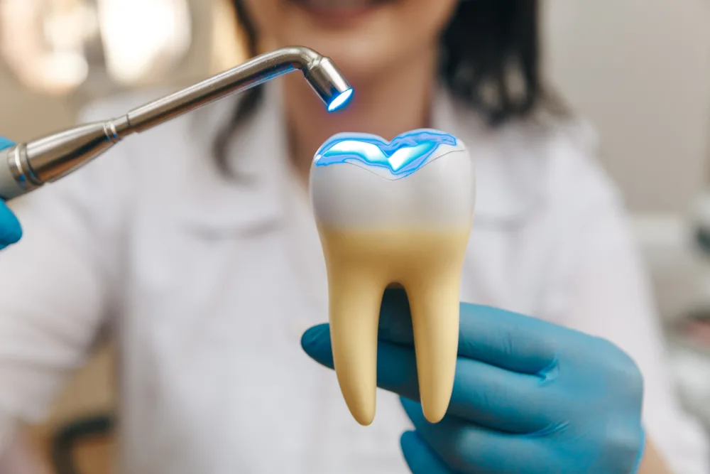 Benefits of Tooth Colored Fillings